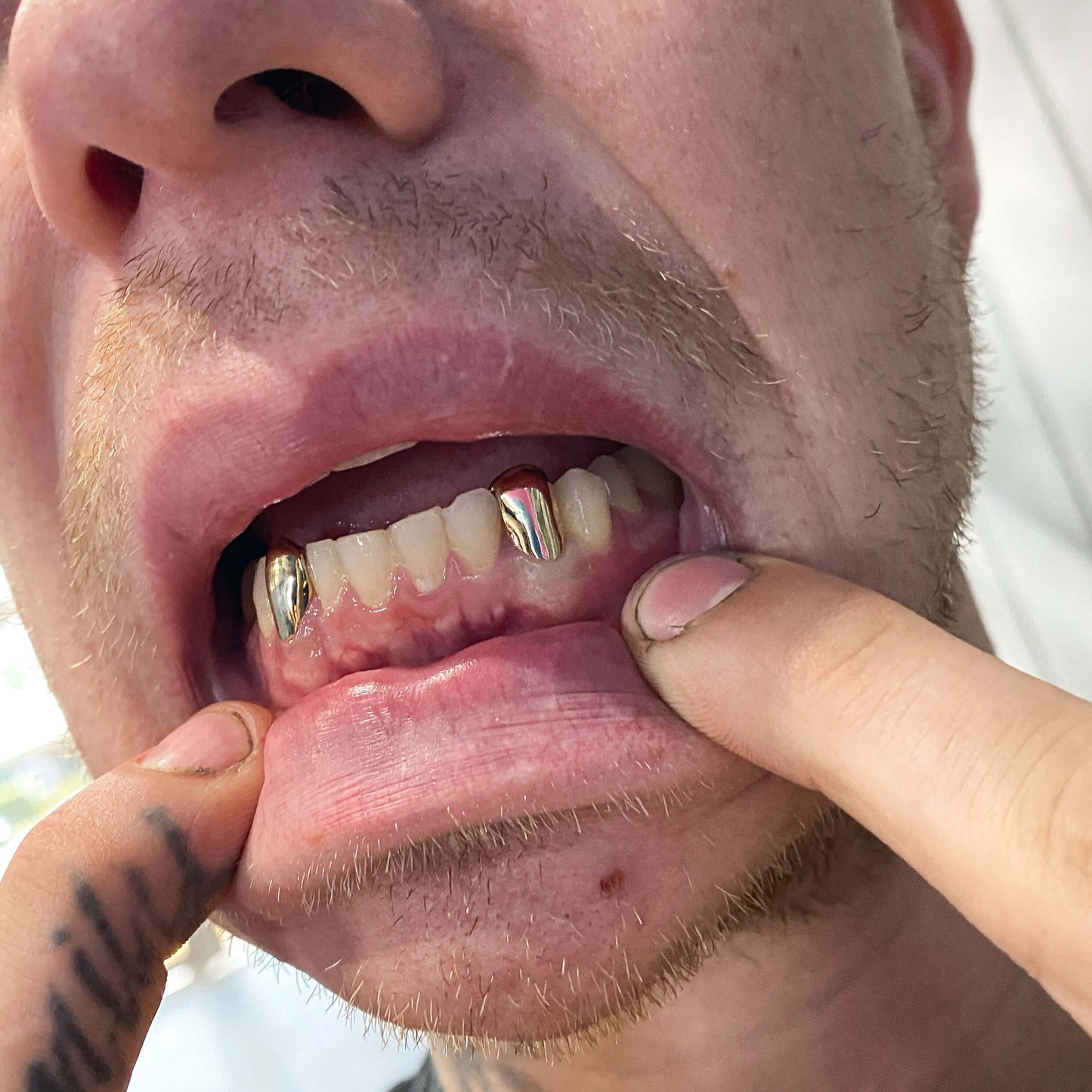 One (1) Single Plain Cap Custom Made Grillz