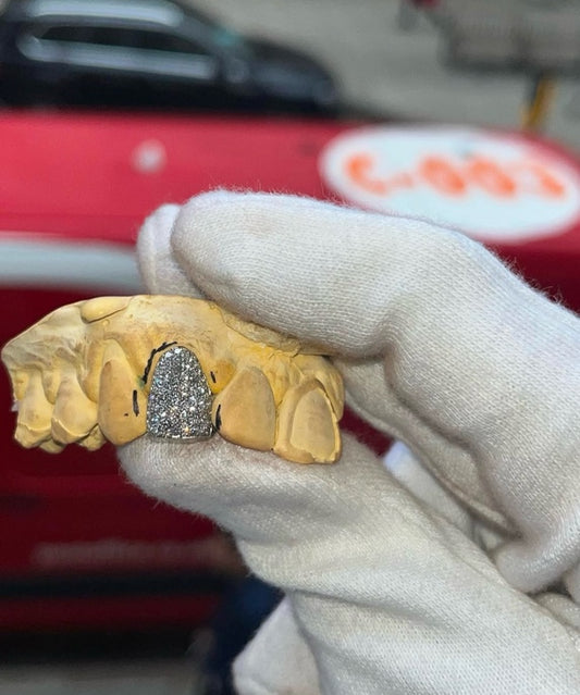 Iced Out Diamond Single Cap Custom Made Grillz