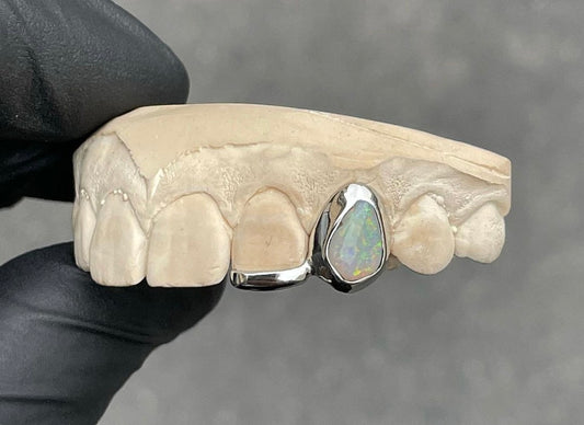 Opal Gemstone Inlay Custom Made Grillz