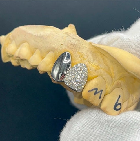 Iced Out Diamond Tooth & Plain Cap Custom Made Grillz