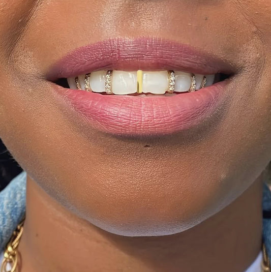 Iced Out Diamond Gap Filler Cap Custom Made Grillz