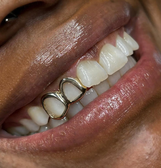 Double Open Face Window Custom Made Grillz