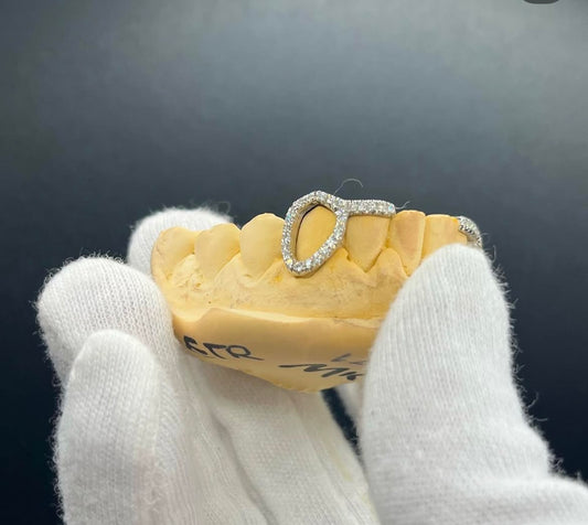Fully Iced Out Diamond Open Face Window Inlay Custom Made Grillz