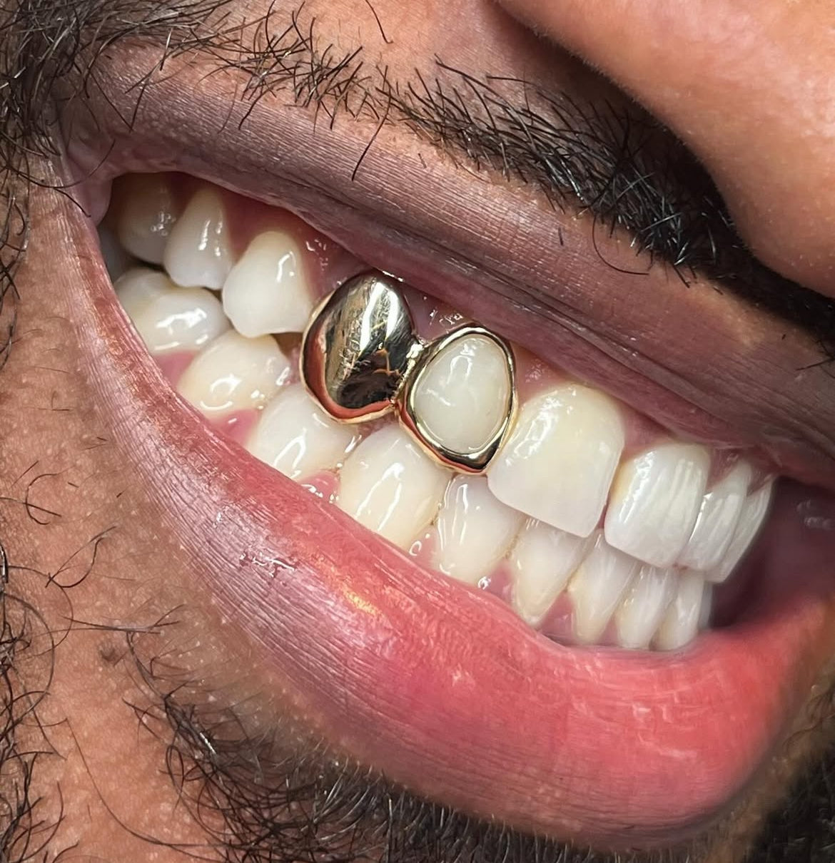 One (1) Single Plain Cap Custom Made Grillz