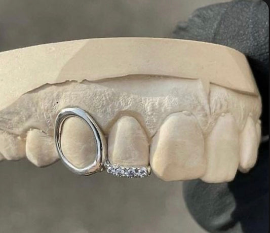 Iced Out Diamond Open Face Window Inlay Custom Made Grillz